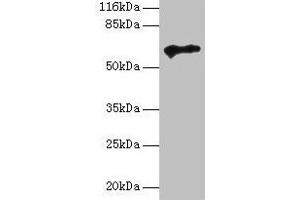Western blot All lanes: TPTE antibody at 2 μg/mL + HepG2 whole cell lysate Secondary Goat polyclonal to rabbit IgG at 1/10000 dilution Predicted band size: 65, 63, 61, 50 kDa Observed band size: 65 kDa (TPTE 抗体  (AA 175-380))