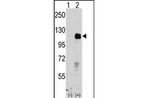 Western blot analysis of EphB4 (arrow) using rabbit polyclonal EphB4 Antibody (ABIN391924 and ABIN2841734). (EPH Receptor B4 抗体)