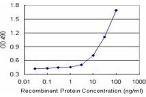 ELISA image for C1QA (Human) Matched Antibody Pair (ABIN1340859)