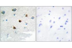 Immunohistochemistry analysis of paraffin-embedded human brain tissue, using DUSP4 Antibody. (DUSP4 抗体  (AA 81-130))