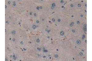 Detection of CYLD in Human Liver Tissue using Polyclonal Antibody to Cylindromatosis (CYLD) (CYLD 抗体  (AA 170-338))