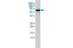 TOE1 monoclonal antibody (M01), clone 1D8 Western Blot analysis of TOE1 expression in Jurkat . (TOE1 抗体  (AA 1-510))