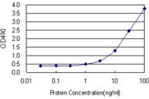 S100A8 (Human) Matched Antibody Pair