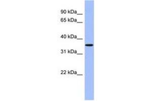 Image no. 1 for anti-Protein Phosphatase, Mg2+/Mn2+ Dependent, 1A (PPM1A) (AA 107-156) antibody (ABIN6744214) (PPM1A 抗体  (AA 107-156))