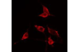 ABIN6274753 staining Hela cells by IF/ICC. (RPS23 抗体  (N-Term))