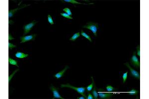 Immunofluorescence of purified MaxPab antibody to PFKFB1 on HeLa cell.