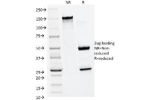 SDS-PAGE Analysis Purified MMP2 Monoclonal Antibody (MMP2/1501). (MMP2 抗体  (AA 444-575))
