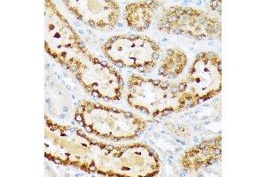 Immunohistochemistry of paraffin-embedded rat kidney using ENTPD5 Rabbit mAb (ABIN7266895) at dilution of 1:100 (40x lens). (ENTPD5 抗体)