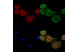 ABIN6257902 and ABIN6274337 staining Hela cells by IF/ICC. (IB2 抗体  (Internal Region))