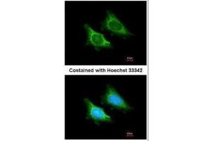 ICC/IF Image Immunofluorescence analysis of methanol-fixed HeLa, using MRPS5, antibody at 1:200 dilution. (MRPS5 抗体)