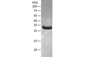 PRMT1 Protein (AA 1-361) (His tag)