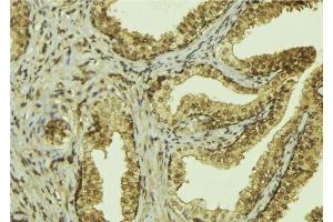 ABIN6276526 at 1/100 staining Mouse colon tissue by IHC-P. (MSH2 抗体  (C-Term))