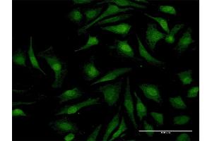 Immunofluorescence of purified MaxPab antibody to RELB on HeLa cell.