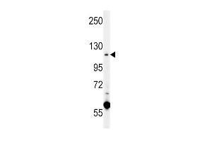 CACNA2D4 Antibody (N-term) (ABIN651895 and ABIN2840441) western blot analysis in K562 cell line lysates (15 μg/lane). (CACNA2D4 抗体  (N-Term))