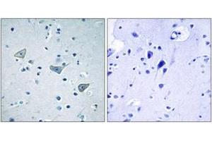 Immunohistochemistry analysis of paraffin-embedded human brain tissue, using GPR158 Antibody. (GPR158 抗体  (AA 1-50))