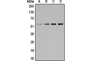 Western blot analysis of SGK1/2 expression in Jurkat (A), HeLa (B), NIH3T3 (C), PC12 (D) whole cell lysates. (SGK1/2 (Center) 抗体)