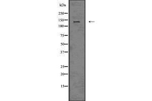 Western Blotting (WB) image for anti-Integrin, alpha X (Complement Component 3 Receptor 4 Subunit) (ITGAX) (N-Term) antibody (ABIN6260570)