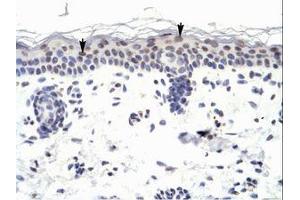 Image no. 1 for anti-Zinc Finger Protein 223 (ZNF223) (AA 95-144) antibody (ABIN6735983) (ZNF223 抗体  (AA 95-144))