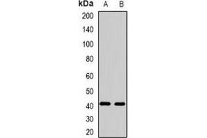 Western blot analysis of FBXO32 expression in mouse heart (A), mouse skeletal muscle (B) whole cell lysates. (FBXO32 抗体)