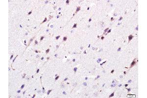 Paraformaldehyde-fixed, paraffin embedded rat brain, Antigen retrieval by boiling in sodium citrate buffer (pH6. (Golgin B1 (GOLGB1) (AA 751-850) 抗体)