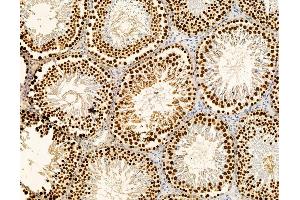 ABIN7095890 and ABIN7099952 at 1/100 staining rat testis tissue by IHC-P.