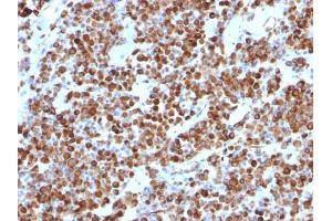 Immunohistochemistry (IHC) image for anti-Vimentin (VIM) antibody (ABIN6940879)