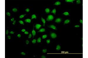 Immunofluorescence of monoclonal antibody to TFAP4 on HeLa cell. (TFAP4 抗体  (AA 93-192))