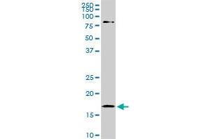 Western Blotting (WB) image for anti-Cofilin 1 (CFL1) (AA 1-167) antibody (ABIN598606) (Cofilin 抗体  (AA 1-167))