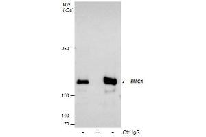 IP Image Immunoprecipitation of SMC1A protein from 293T whole cell extracts using 5 μg of SMC1A antibody [N1N2], N-term, Western blot analysis was performed using SMC1A antibody [N1N2], N-term, EasyBlot anti-Rabbit IgG  was used as a secondary reagent. (SMC1A 抗体  (N-Term))