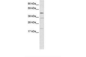 Image no. 1 for anti-TEA Domain Family Member 1 (SV40 Transcriptional Enhancer Factor) (TEAD1) (N-Term) antibody (ABIN202462) (TEAD1 抗体  (N-Term))