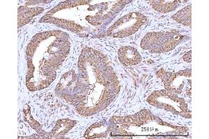 IHC analysis of RPN1 using anti-RPN1 antibody (ABIN7600447). (RPN1 抗体  (AA 196-495))