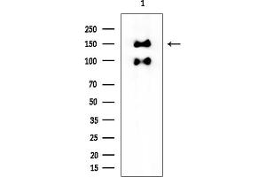 Western blot analysis of lysates from Rat brain, using LATS2 Mouse Monoclonal Antibody at 1/1000 dilution.