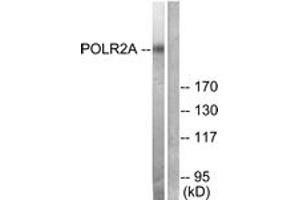 Western blot analysis of extracts from COS7 cells, treated with EGF 200ng/ml 30', using POLR2A (Ab-1619) Antibody. (POLR2A/RPB1 抗体  (AA 1585-1634))