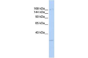 Western Blotting (WB) image for anti-Lysine (K)-Specific Demethylase 6A (KDM6A) antibody (ABIN2458408) (KDM6A 抗体)