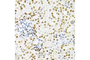 Immunohistochemistry of paraffin-embedded mouse kidney using DKC1 Antibody (ABIN3022640, ABIN3022641, ABIN1512829 and ABIN6218993) at dilution of 1:200 (40x lens). (DKC1 抗体  (AA 245-514))