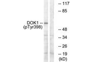 Western blot analysis of extracts from K562 cells treated with Starvation 24h, using p62 Dok (Phospho-Tyr398) Antibody. (DOK1 抗体  (pTyr398))