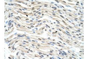 THOC3 antibody was used for immunohistochemistry at a concentration of 4-8 ug/ml to stain Myocardial cells (arrows) in Human Heart. (THO Complex 3 抗体  (Middle Region))