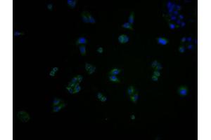 Immunofluorescence staining of Hela cells with ABIN7148898 at 1:100, counter-stained with DAPI. (CDK6 抗体  (AA 102-326))