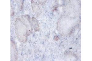 Immunohistochemistry of paraffin-embedded human prostate tissue using ABIN7143582 at dilution of 1:100 (AFG3L2 抗体  (AA 550-759))