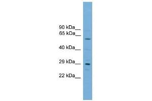 Western Blot showing RPAIN antibody used at a concentration of 1-2 ug/ml to detect its target protein. (RPAIN 抗体  (C-Term))