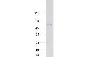 Western Blotting (WB) image for Oxysterol Binding Protein-Like 2 (OSBPL2) (Transcript Variant 1) protein (Myc-DYKDDDDK Tag) (ABIN2727987)