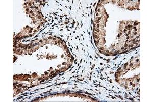 Immunohistochemical staining of paraffin-embedded liver tissue using anti-APP mouse monoclonal antibody. (APP 抗体)