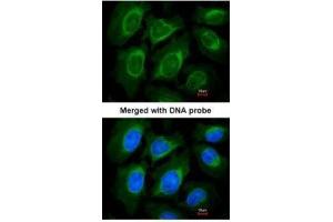 ICC/IF Image Immunofluorescence analysis of paraformaldehyde-fixed HeLa, using CCN3 , antibody at 1:200 dilution. (NOV 抗体  (Center))