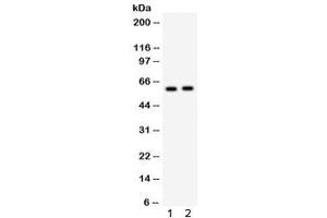 Western blot testing of 1) rat liver and 2) mouse liver lysate with CYP7A1 antibody.
