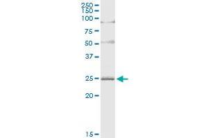 Immunoprecipitation of ARL4D transfected lysate using anti-ARL4D MaxPab rabbit polyclonal antibody and Protein A Magnetic Bead , and immunoblotted with ARL4D MaxPab mouse polyclonal antibody (B01) . (ARL4D 抗体  (AA 1-201))