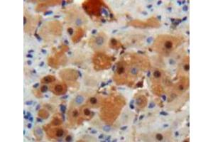 Used in DAB staining on fromalin fixed paraffin-embedded Liver tissue (IGF1 抗体  (AA 48-118))
