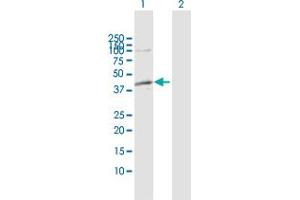 Western Blotting (WB) image for anti-Alcohol Dehydrogenase 1C (Class I), gamma Polypeptide (ADH1C) (AA 1-375) antibody (ABIN513128)