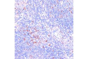 Immunohistochemistry of paraffin-embedded mouse spleen using Zyxinin antibody (ABIN3023008, ABIN3023009, ABIN3023010 and ABIN6219343) at dilution of 1:100 (40x lens). (ZYX 抗体  (AA 1-300))