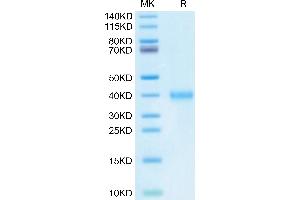 Mouse IGSF11 on Tris-Bis PAGE under reduced condition. (IGSF11 Protein (AA 23-240) (His tag))