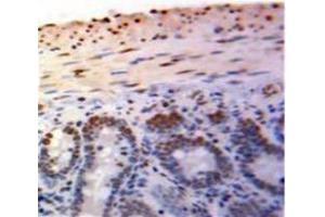 Used in DAB staining on fromalin fixed paraffin-embedded Bowels tissue (PML 抗体  (AA 59-239))